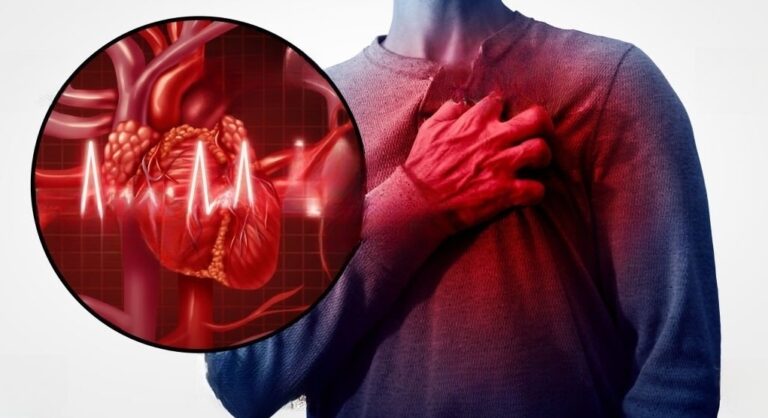 Managing Hypertension & Heart Disease