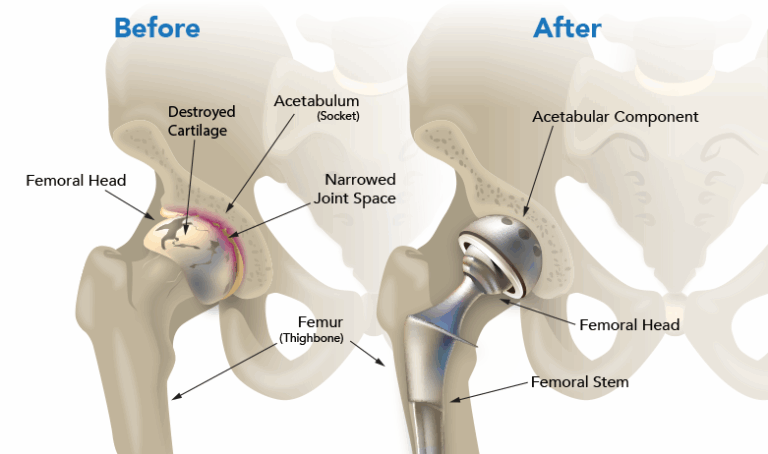 Orthopedic - Dr Chavan Hospital Nashik