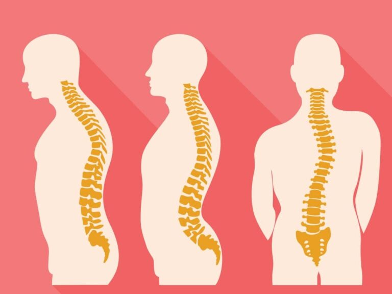 Spine Disorders & Treatment