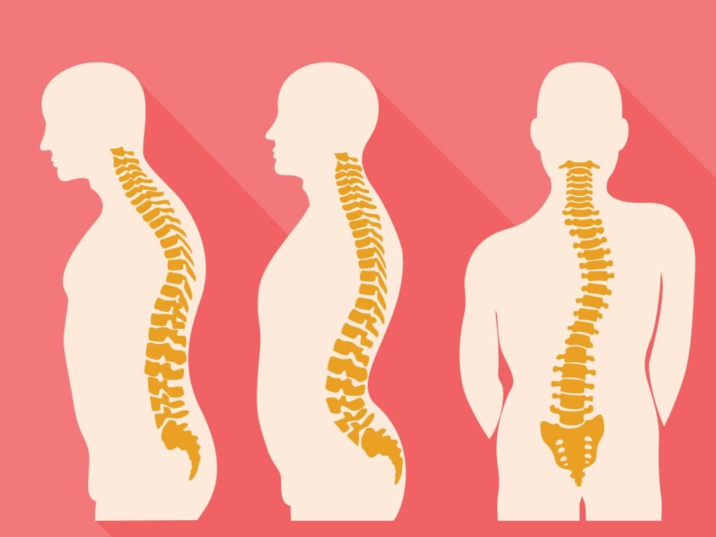 Spine Disorders & Treatment