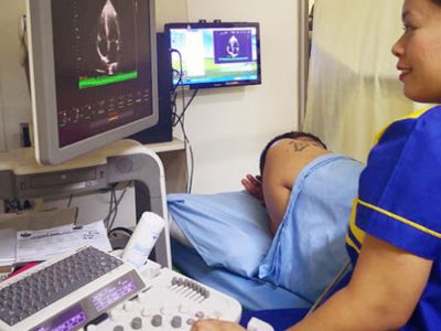 2D-Echo-with-Doppler 2D Echo and Doppler Services | Chavan Hospital Nashik