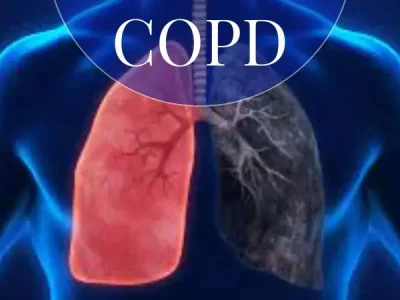 Asthma & COPD Management Asthma & COPD Management