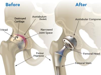 Orthopedic - Dr Chavan Hospital Nashik