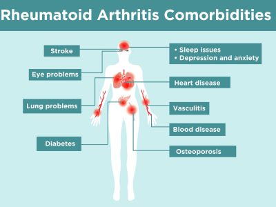 R (2) Primary Care Rheumatology – SLE & Various Arthriti