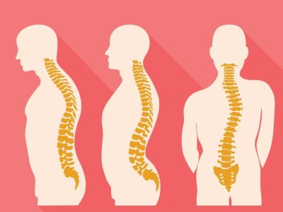 Spine Disorders & Treatment
