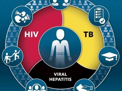 tb-policy-brief-884×500 Comprehensive Care for Infectious Diseases: HIV, TB, and Hepatitis